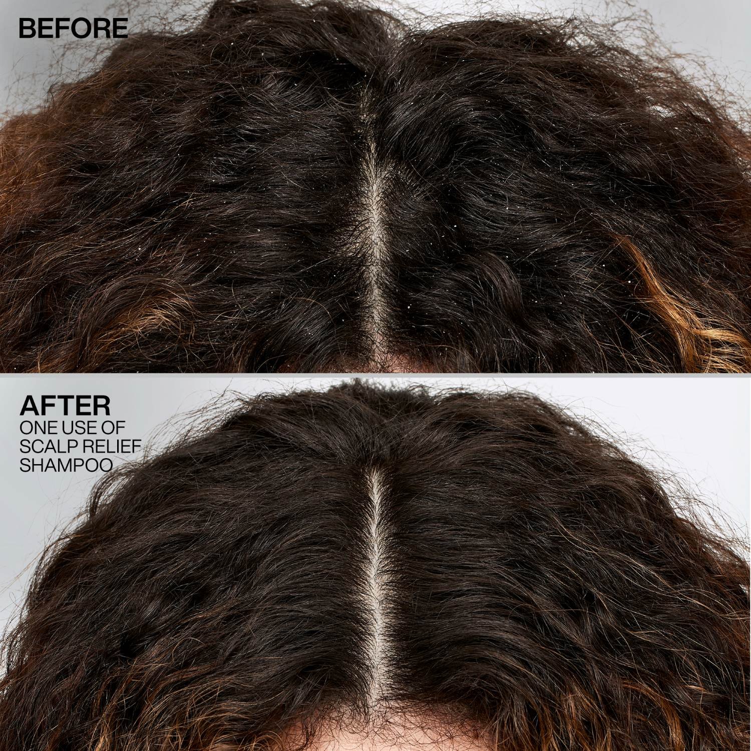 Scalp Relief Dandruff Control Shampoo Fra Redken